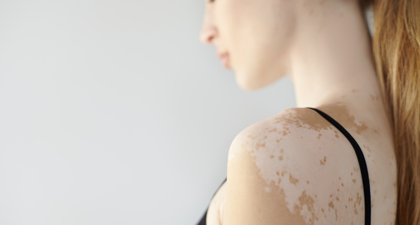 Знак свыше: людей с этой меткой на теле лучше обходить стороной - мудрость наших предков